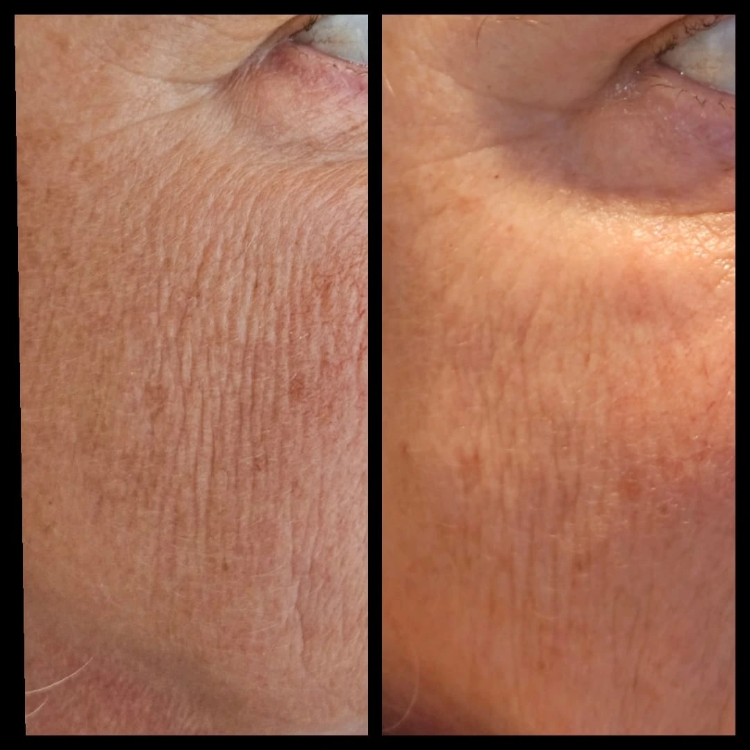 BeautyStudio Bad Salzuflen Galerie